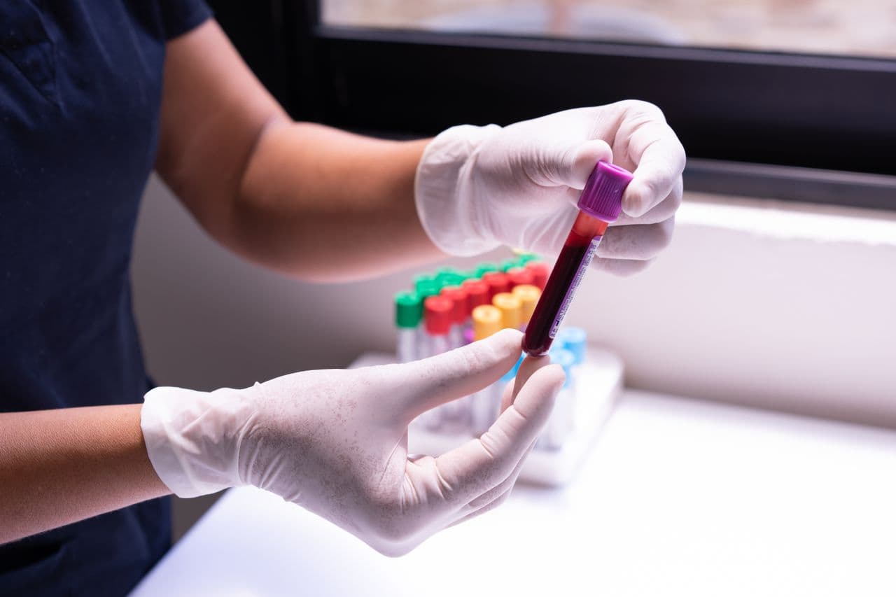 Laboratory technician in gloves handling a labeled specimen tube for diagnostic testing